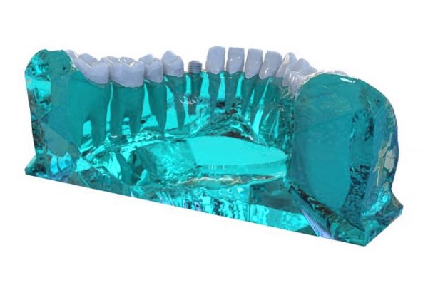 La Impresión 3D se instala en los hospitales españoles